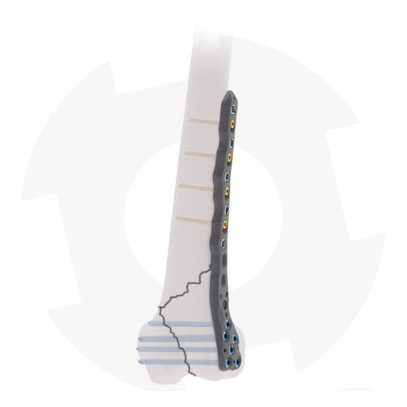 DF Distal de femur