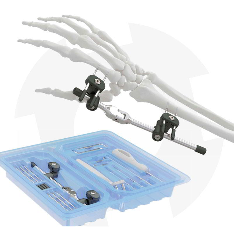 Kit Fijador externo de muñeca.