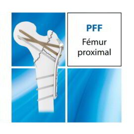 PPF
