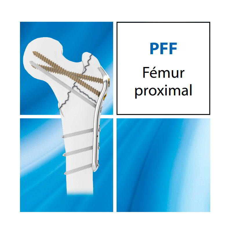 PPF