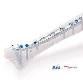 Tibia Acero